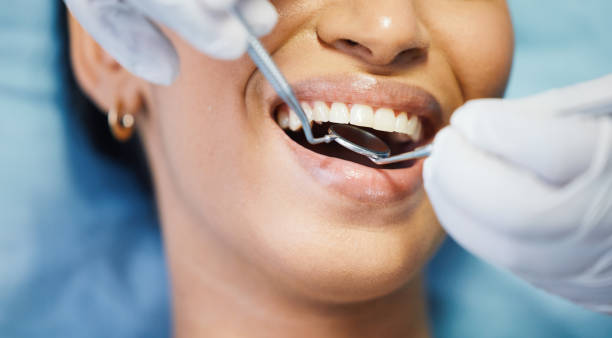 Best Emergency Treatment for Dental Infections or Abscesses in Grenelefe, FL